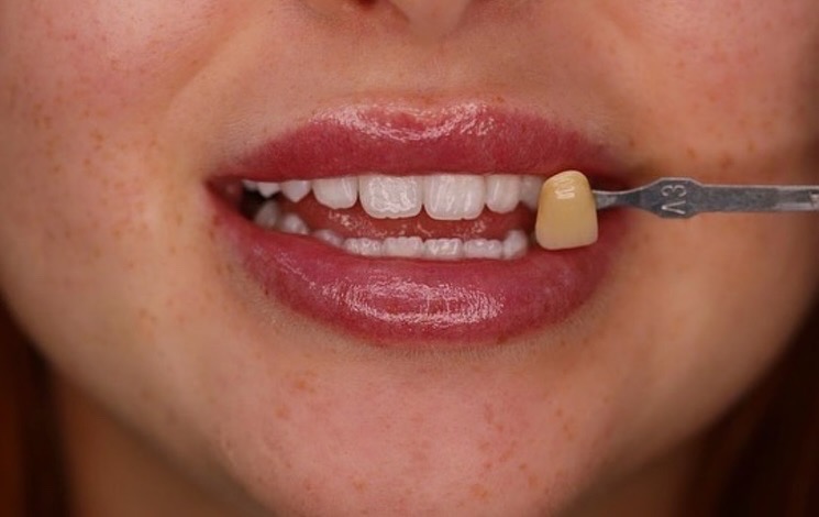 באמצע העמוד